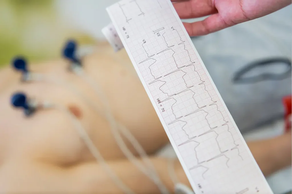 immagine holter ECG  cardiologia - CMD Centro medico